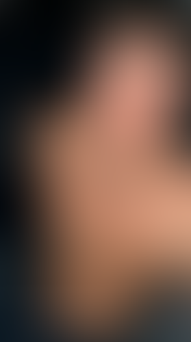 Geblurrte Content-Vorschau