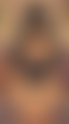Geblurrte Content-Vorschau