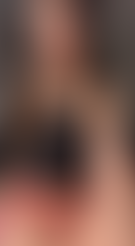 Geblurrte Content-Vorschau