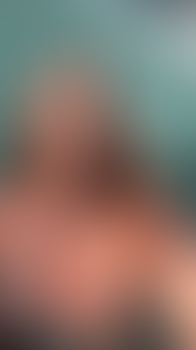 Geblurrte Content-Vorschau