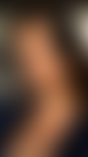 Geblurrte Content-Vorschau