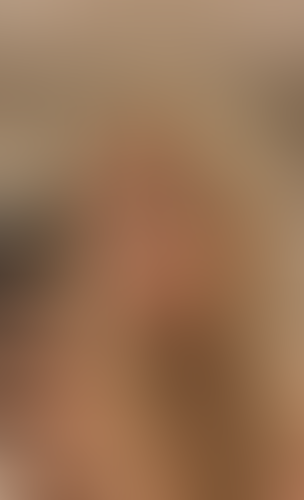 Geblurrte Content-Vorschau