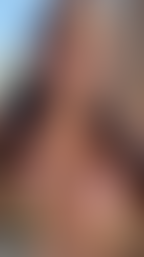 Geblurrte Content-Vorschau