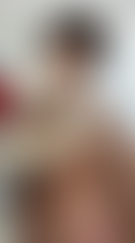 Geblurrte Content-Vorschau