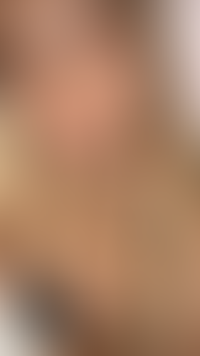 Geblurrte Content-Vorschau