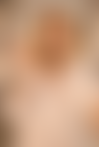 Geblurrte Content-Vorschau