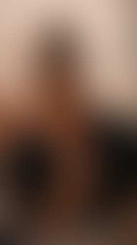 Geblurrte Content-Vorschau