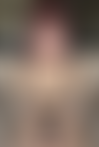 Geblurrte Content-Vorschau