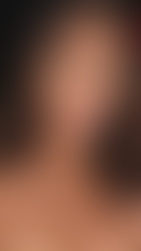 Geblurrte Content-Vorschau