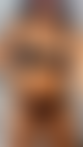 Geblurrte Content-Vorschau