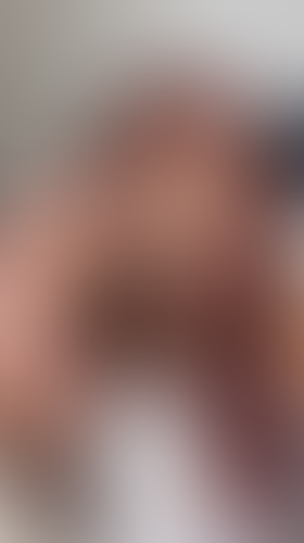 Geblurrte Content-Vorschau
