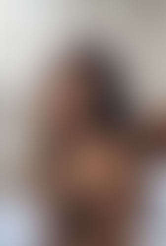 Geblurrte Content-Vorschau
