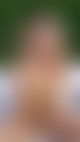 Geblurrte Content-Vorschau