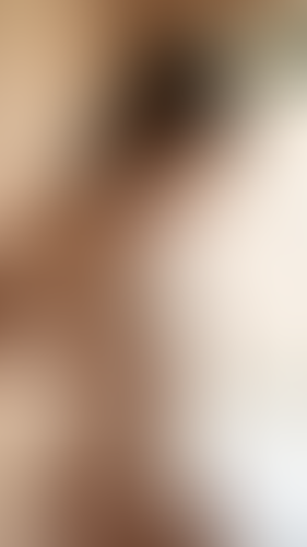 Geblurrte Content-Vorschau