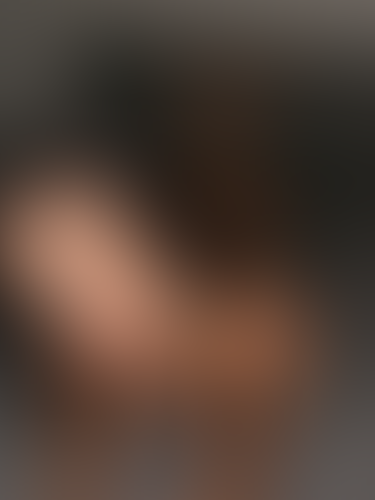 Geblurrte Content-Vorschau