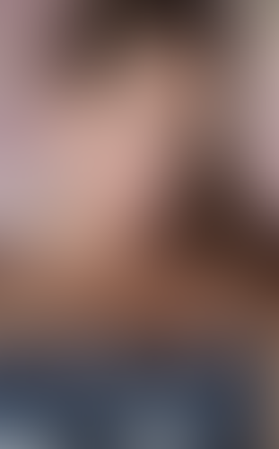 Geblurrte Content-Vorschau