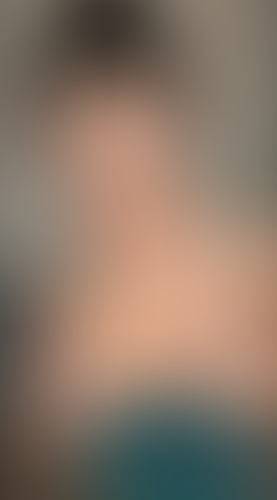 Geblurrte Content-Vorschau