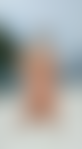 Geblurrte Content-Vorschau