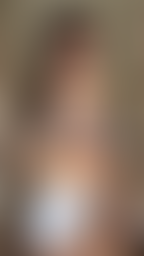 Geblurrte Content-Vorschau
