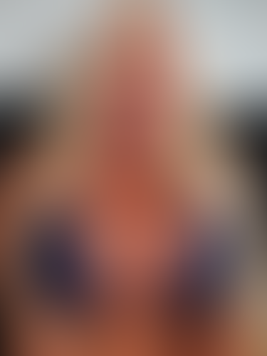Geblurrte Content-Vorschau