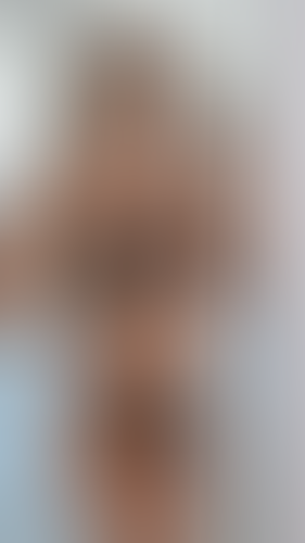Geblurrte Content-Vorschau