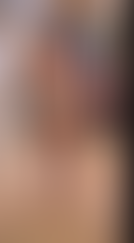 Geblurrte Content-Vorschau