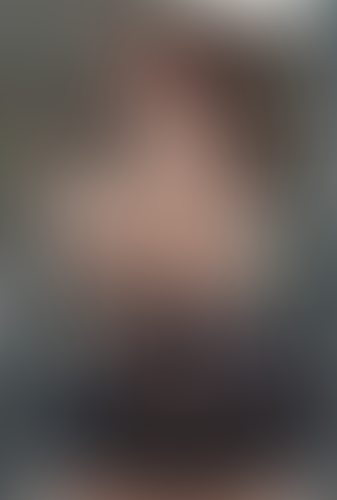 Geblurrte Content-Vorschau