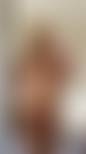 Geblurrte Content-Vorschau