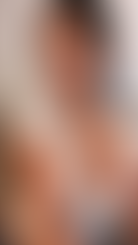 Geblurrte Content-Vorschau