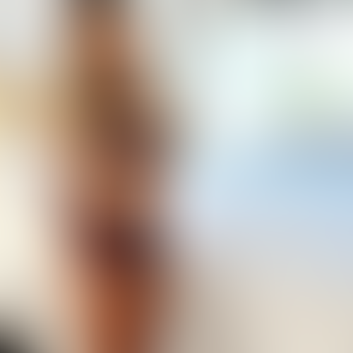 Geblurrte Content-Vorschau