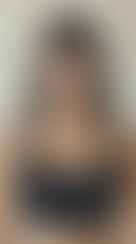 Geblurrte Content-Vorschau