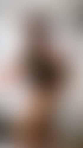 Geblurrte Content-Vorschau