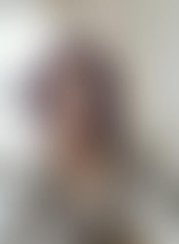 Geblurrte Content-Vorschau