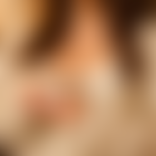 Geblurrte Content-Vorschau