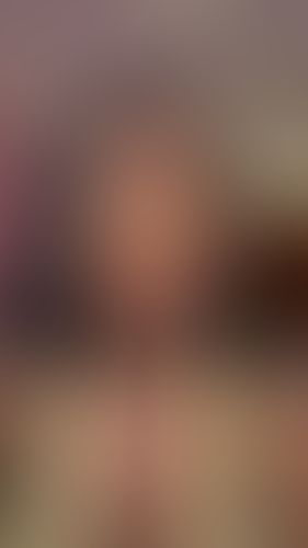 Geblurrte Content-Vorschau