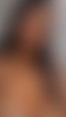 Geblurrte Content-Vorschau