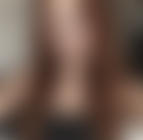 Geblurrte Content-Vorschau