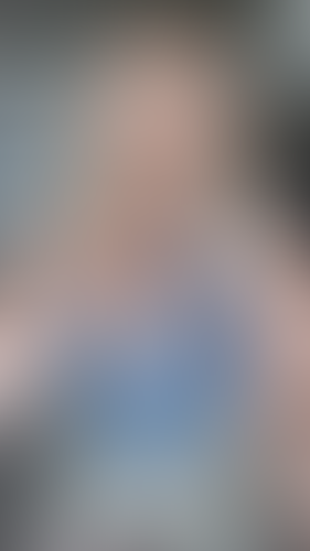 Geblurrte Content-Vorschau