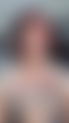 Geblurrte Content-Vorschau