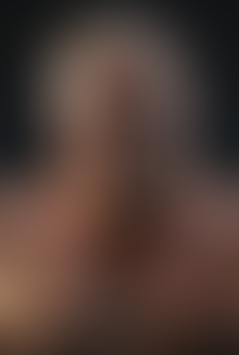 Geblurrte Content-Vorschau