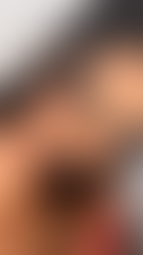 Geblurrte Content-Vorschau