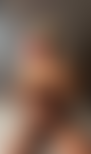 Geblurrte Content-Vorschau