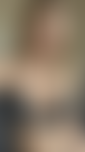 Geblurrte Content-Vorschau