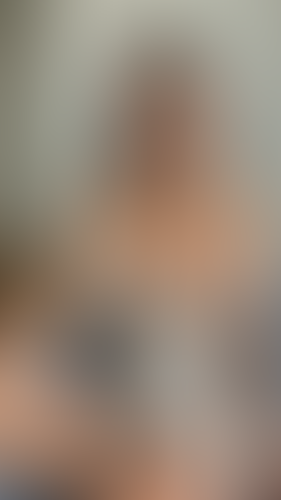 Geblurrte Content-Vorschau
