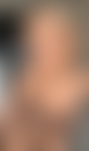 Geblurrte Content-Vorschau