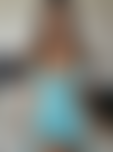 Geblurrte Content-Vorschau