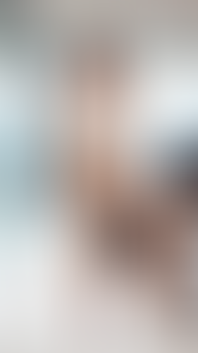 Geblurrte Content-Vorschau