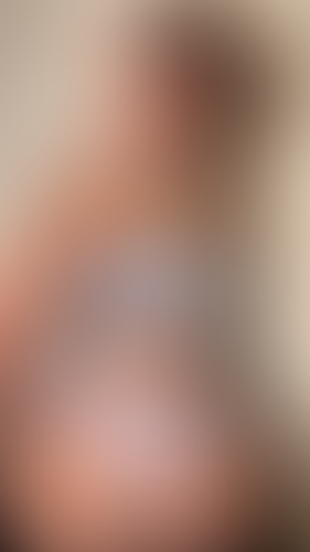 Geblurrte Content-Vorschau