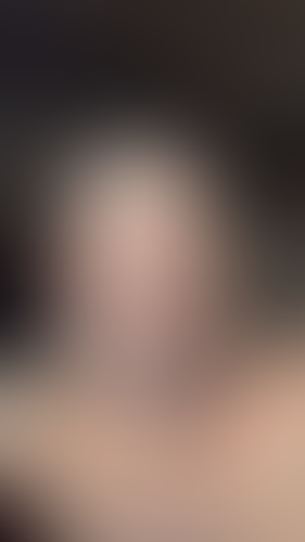 Geblurrte Content-Vorschau