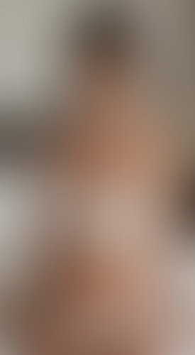 Geblurrte Content-Vorschau